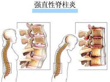 周杰伦、张嘉译饱受不死绝症摧残,如今他儿子也不能幸免?