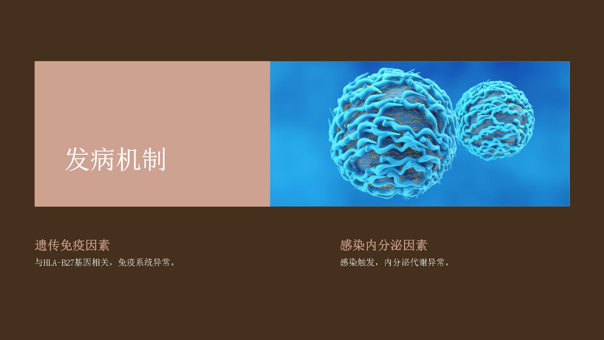 强直性脊柱炎 从诊断到治疗的系统教学